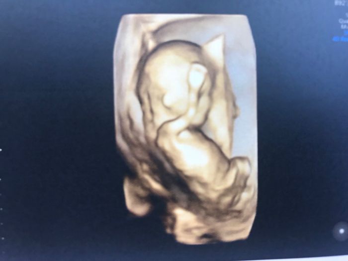 Futuras mamás marzo 2019 - 1