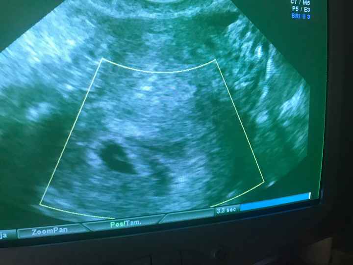 Futuras mamás marzo 2019 - 1