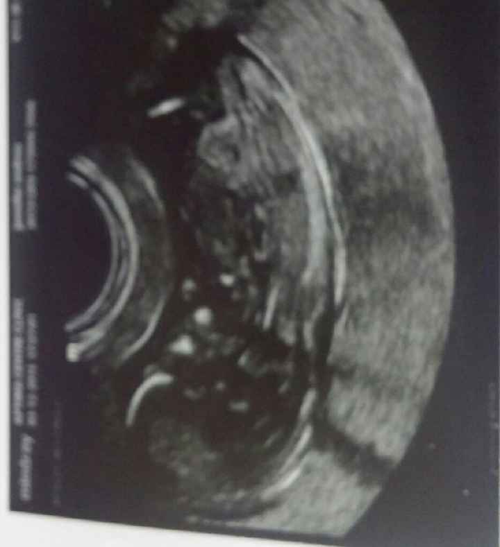 Futuras mamás junio 2016 - 1
