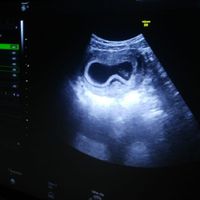 Futuras mamás Septiembre 2020 - 2