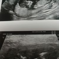 futuras mamis mayo 2022 🤰 - 1