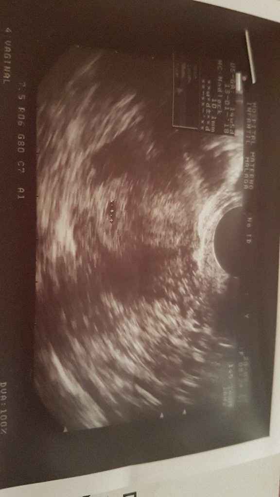 Mamas marzo 2018 - 1
