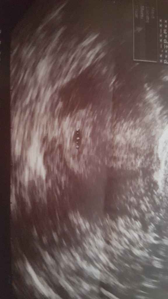 Mamas marzo 2018 - 2