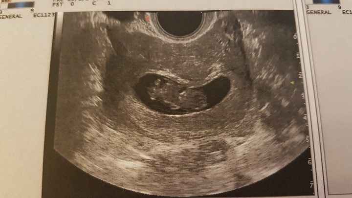¡nuevo! futuras mamis marzo 2018 - 1
