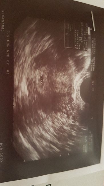 Mamas marzo 2018 - 1