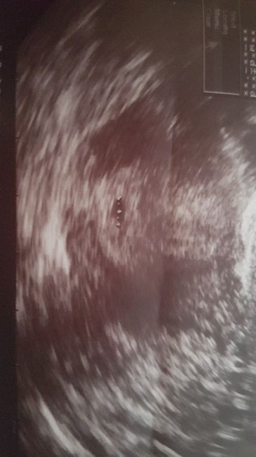 Mamas marzo 2018 - 2