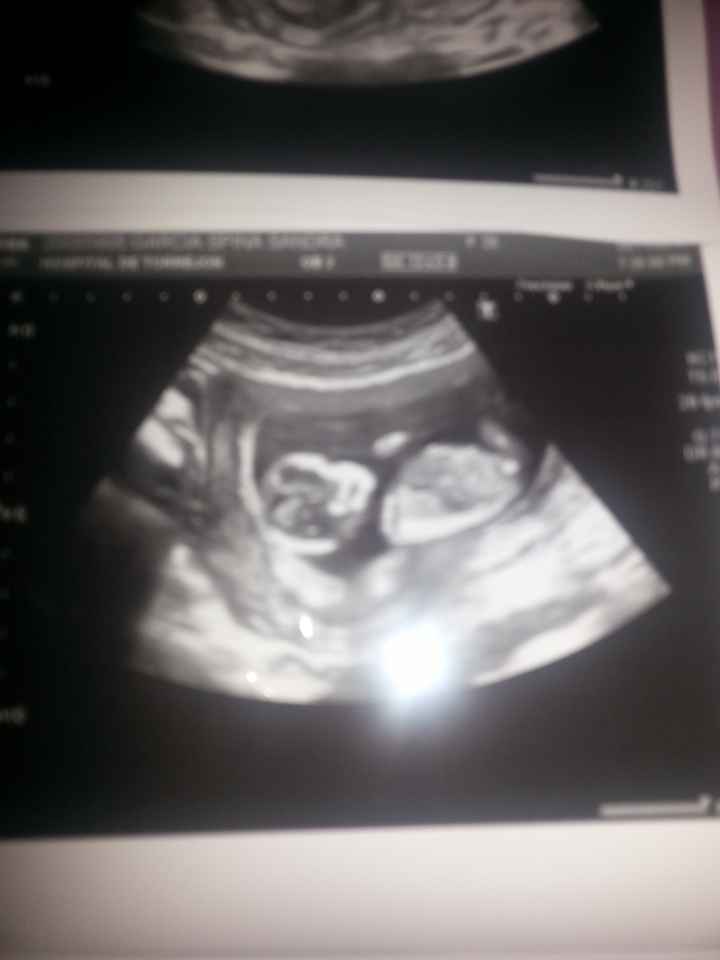 El consultorio de Lita para futuras mamis - 1