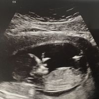 Futuras mamás enero 2019 - 1