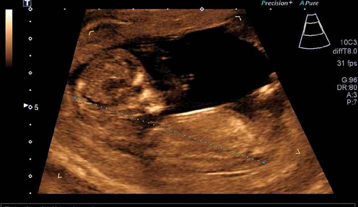 Futuras mamás septiembre 2019 - 1