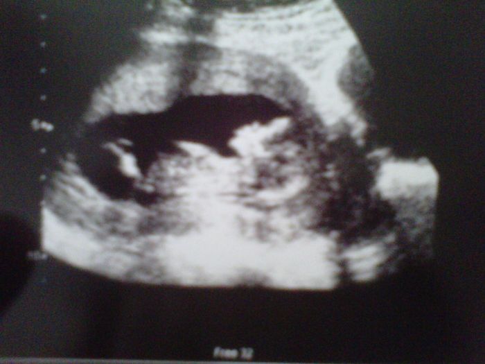 13 semanitas
