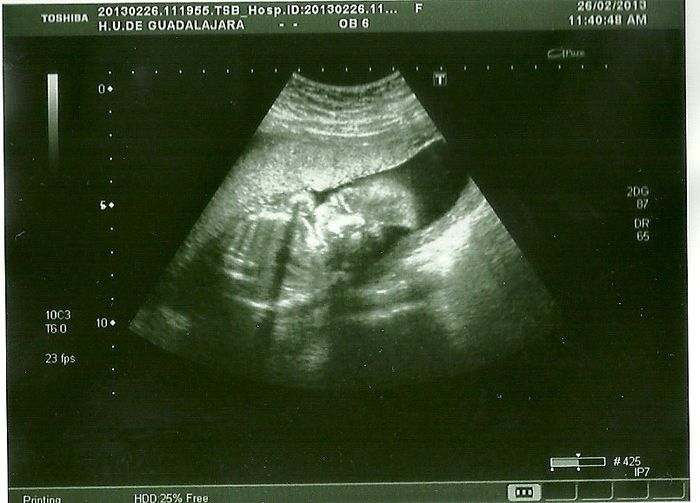 20 semanas