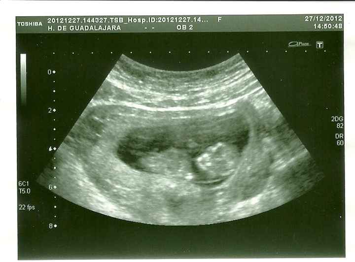 nuestro bebe