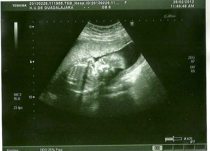 20 semanas