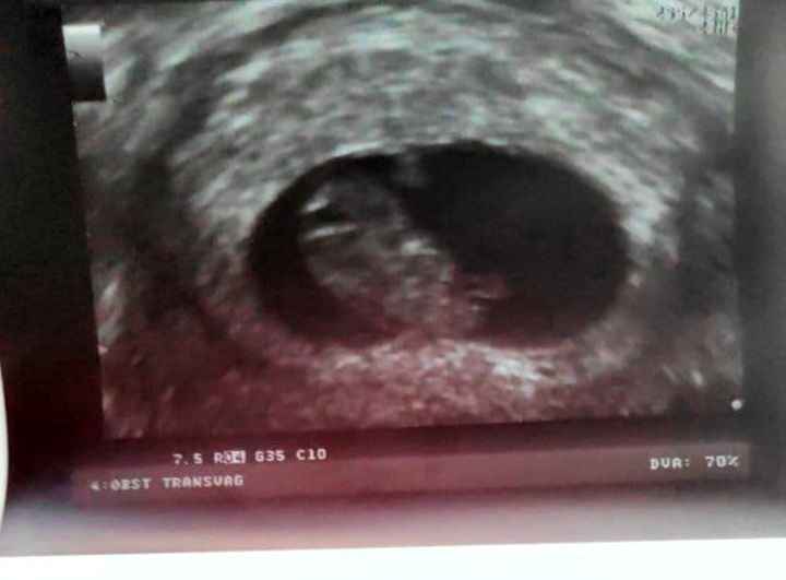8 semanas