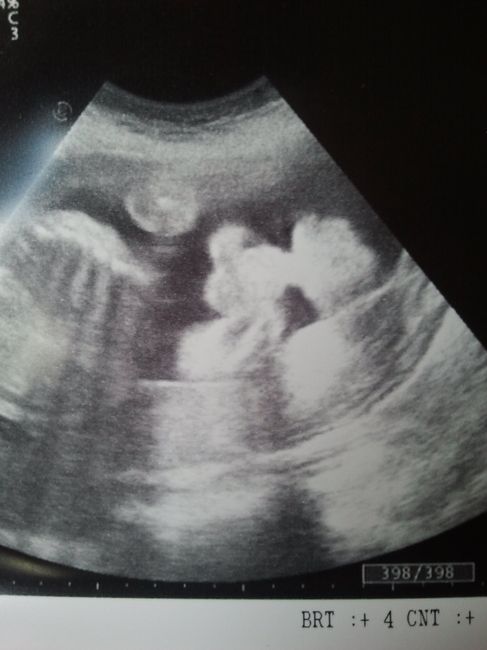 mario 26 semanas