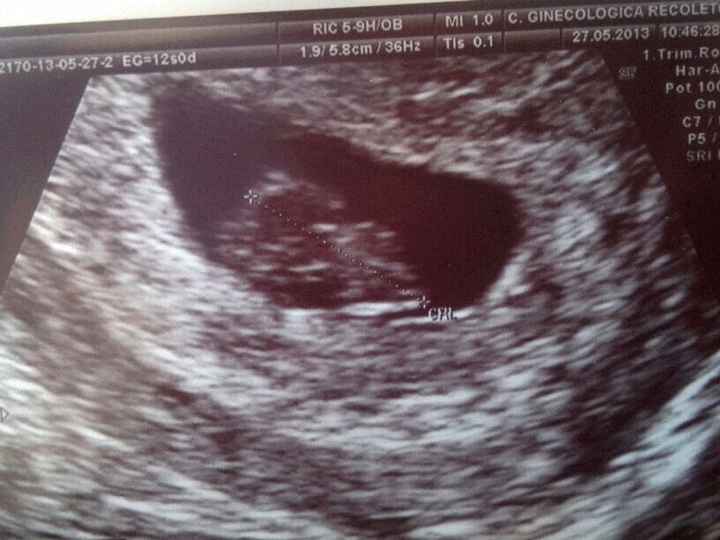 7 semanas