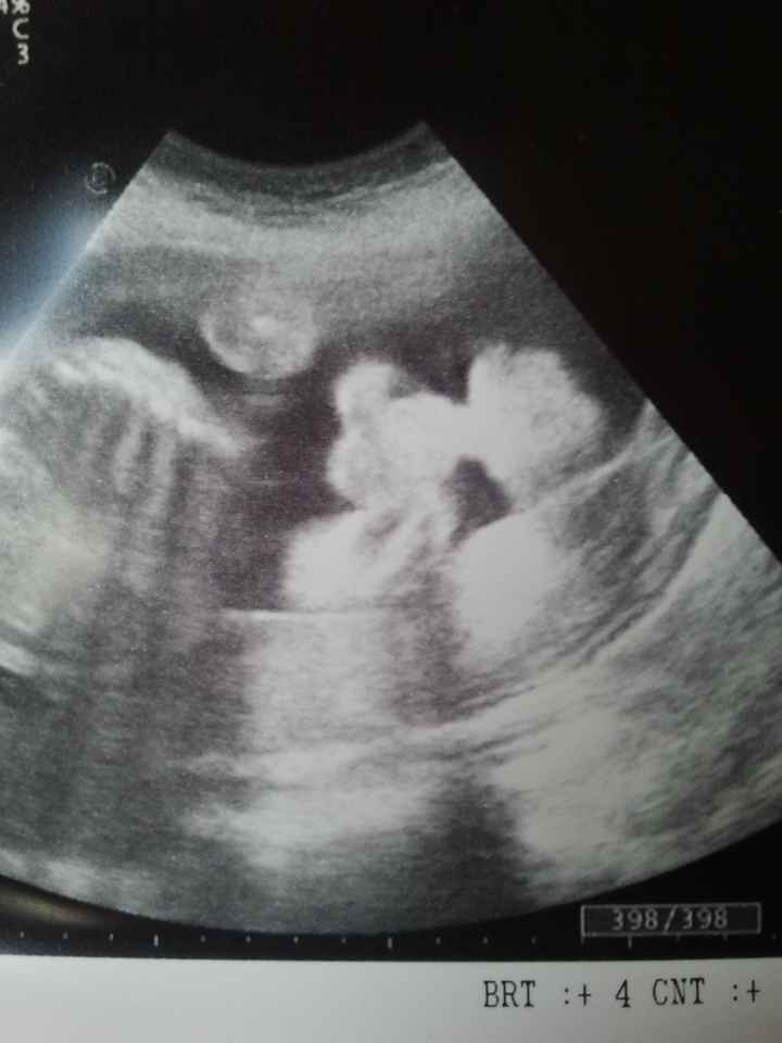 mario 26 semanas