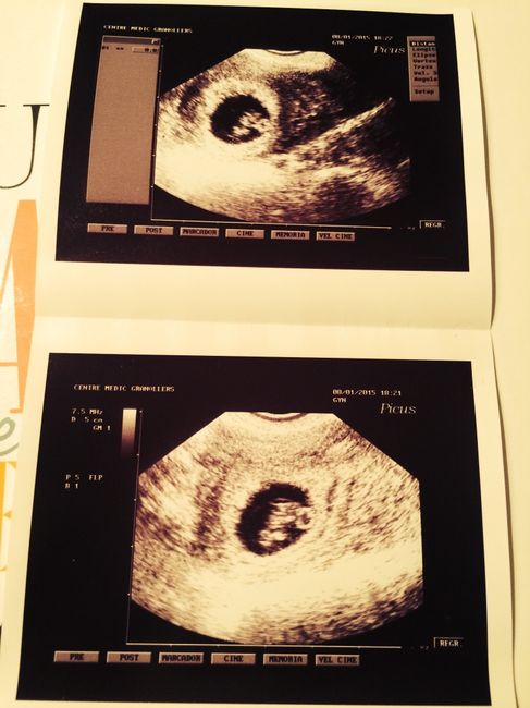 Mamas agosto 2015 - 1