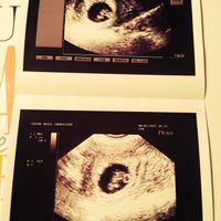 Mamas agosto 2015 - 1