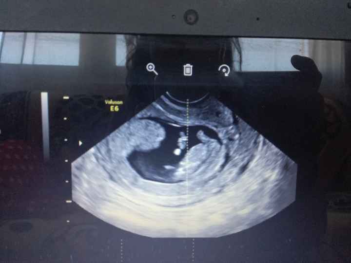 Metodo saad ramzi para saber el sexo del bebe - 1