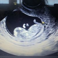 Metodo saad ramzi para saber el sexo del bebe - 2