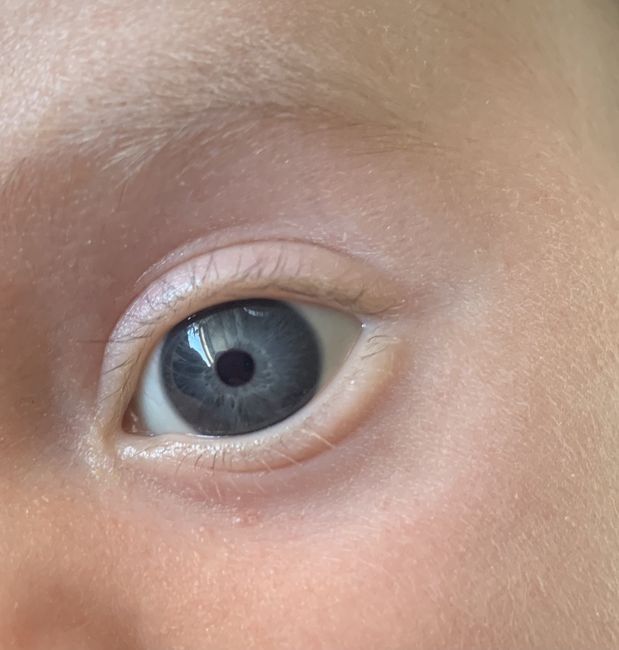 Color de ojos Recién Nacido - 1