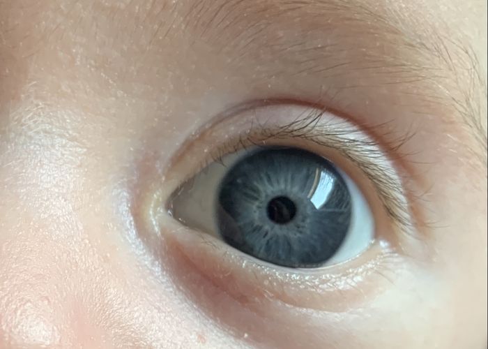 Color de ojos Recién Nacido - 1