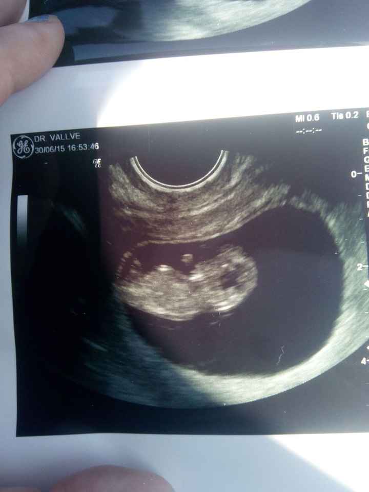 Mi bebe