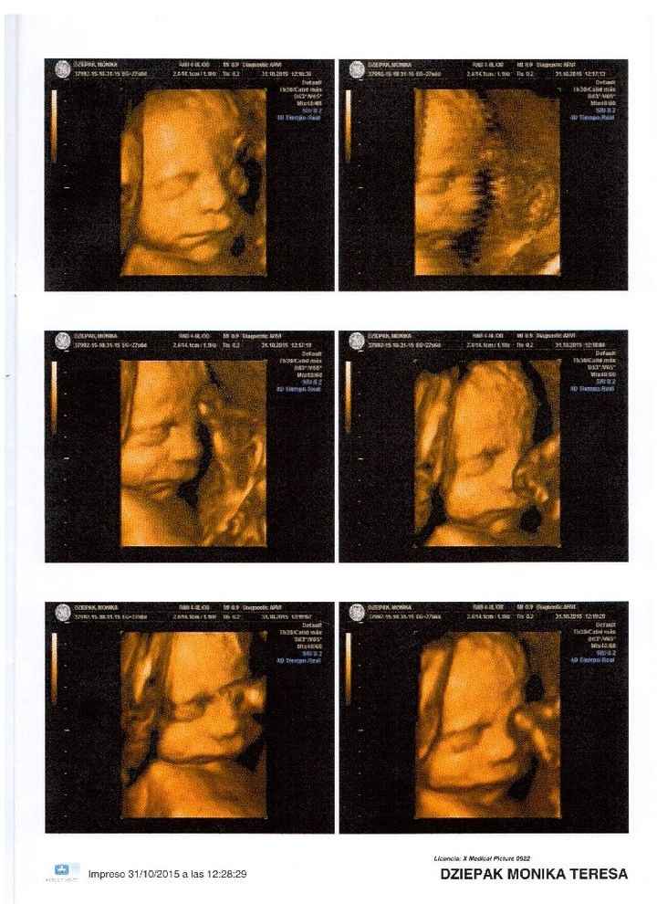 Mamis enero 2016 - 2