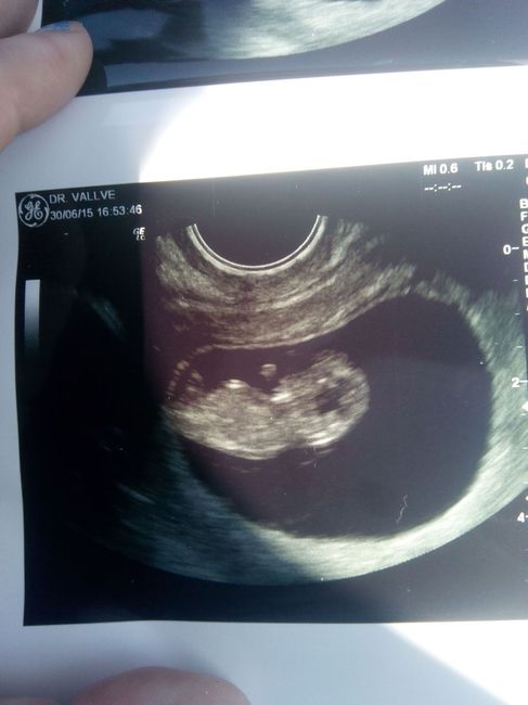 Mi bebe