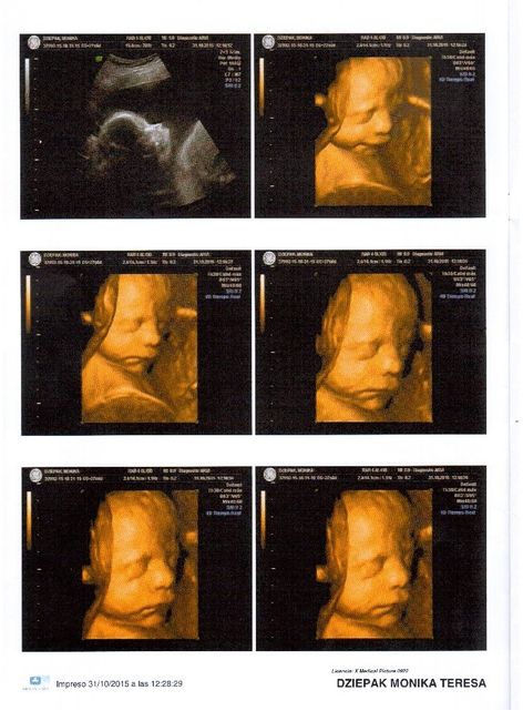 Mamis enero 2016 - 1