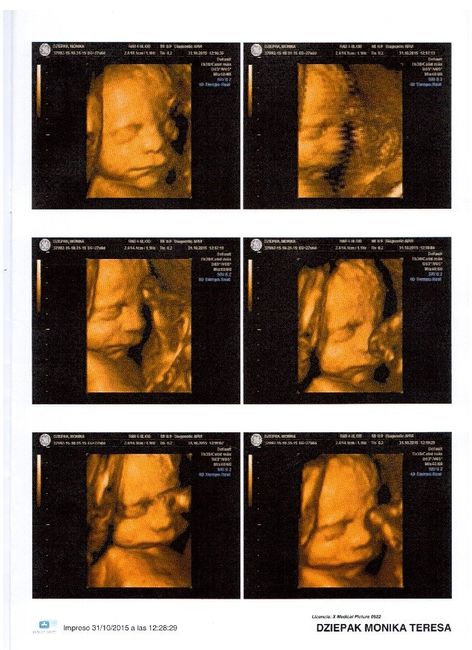 Mamis enero 2016 - 2