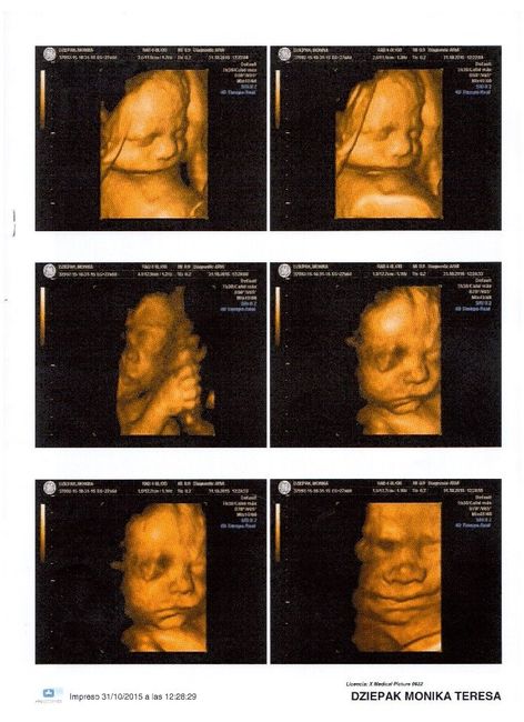 Mamis enero 2016 - 3