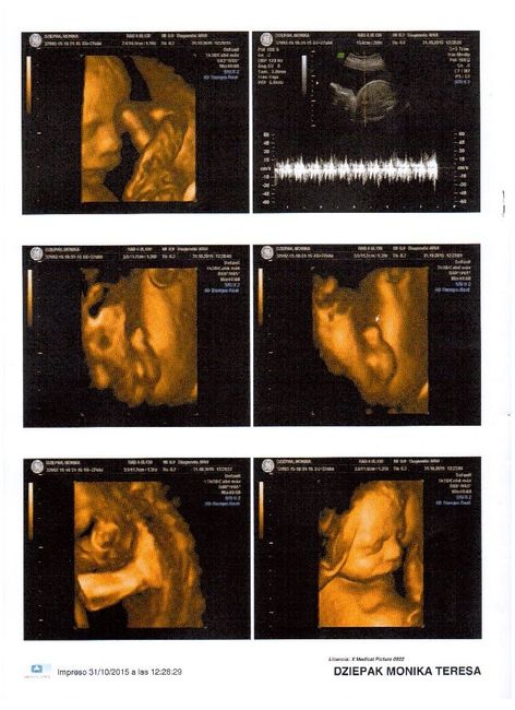 Mamis enero 2016 - 4