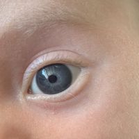 Color de ojos Recién Nacido - 1