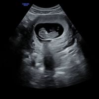 Buscadoras mayo 2023 - 1