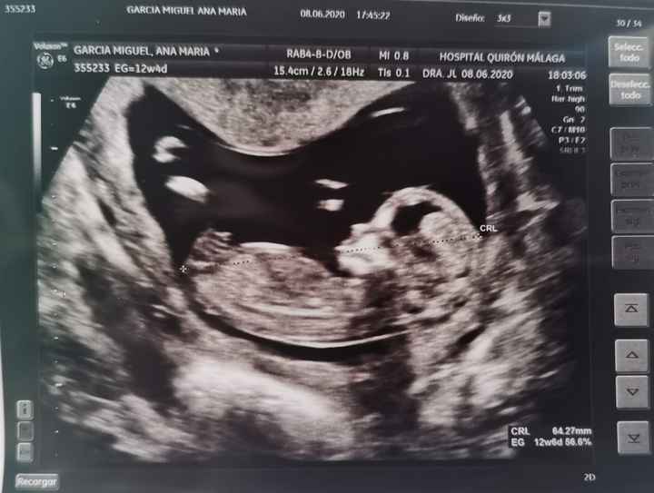 Futuras mamas Diciembre 2020 2