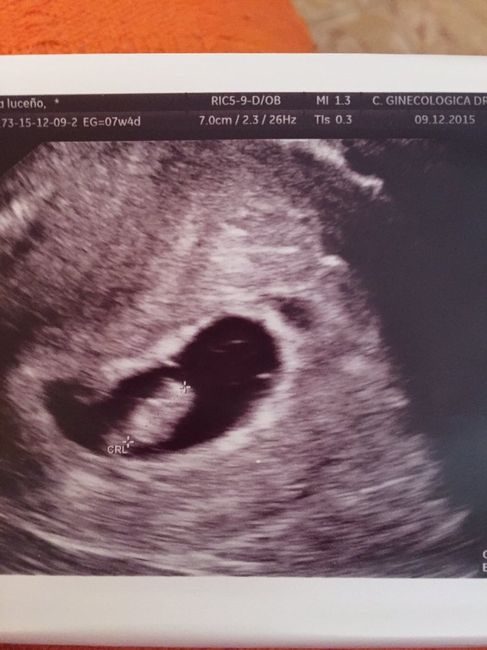Futuras mamas julio 2016 - 1