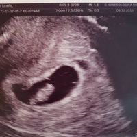 Futuras mamas julio 2016 - 1