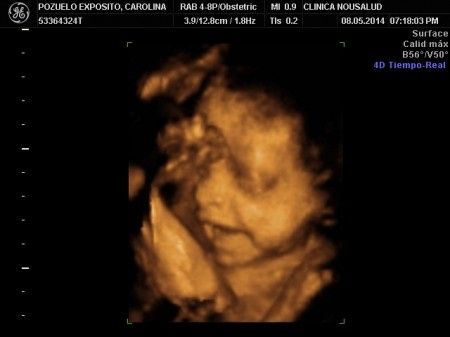 26 semanas