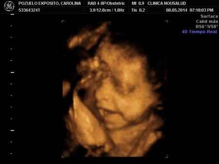 26 semanas