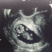El consultorio de Lita para futuras mamis - 1