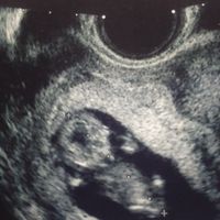 El consultorio de Lita para futuras mamis - 2
