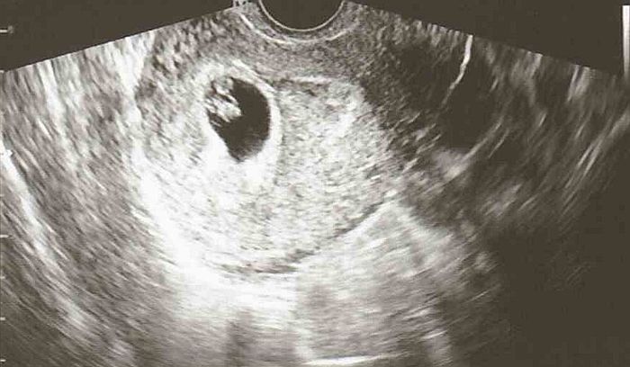Mamas Marzo 2020 - 1