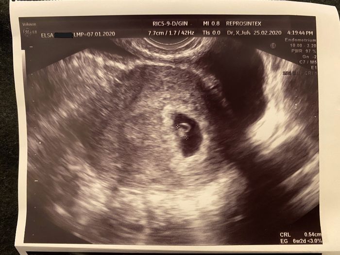 Futuras mamas octubre 2020 - 1
