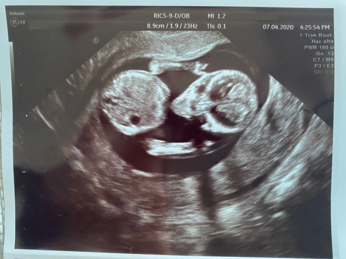 Futuras mamas octubre 2020 - 1