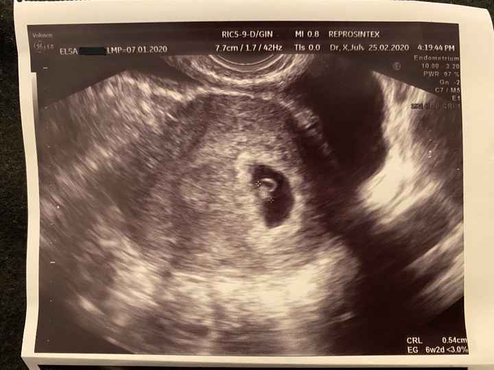 Futuras mamas octubre 2020 - 1