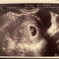 Futuras mamas octubre 2020 - 1