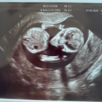 Futuras mamas octubre 2020 - 1
