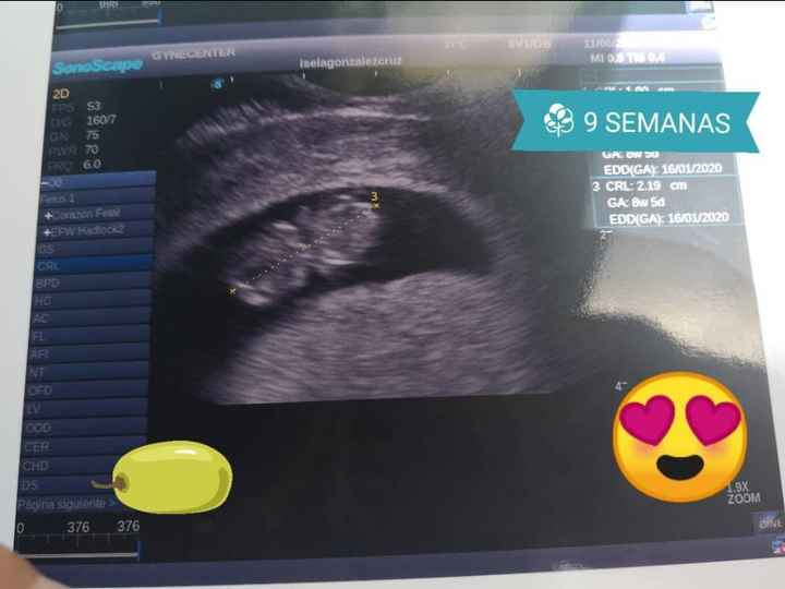 Eco 9 semanas